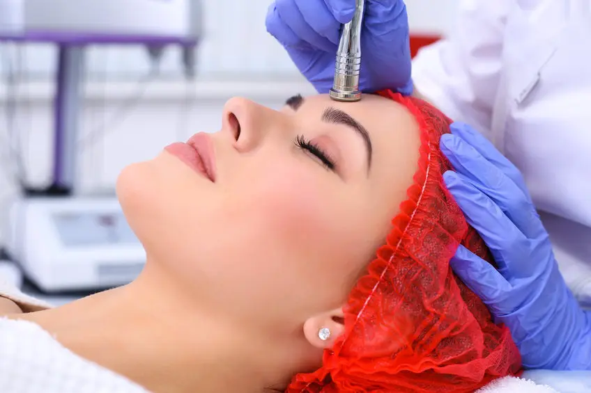 Microdermabrasion treatment