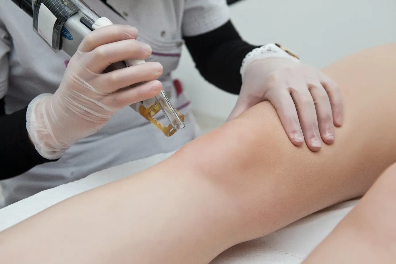 tattoo removal Your Comprehensive Guide to Laser Tattoo Removal