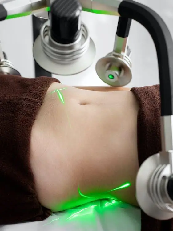 body contouring A woman undergoing a laser treatment for body contouring