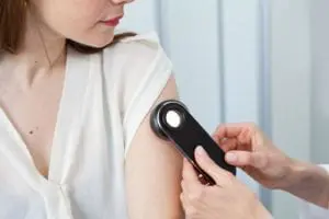 - Suncoast Skin Solutions moles