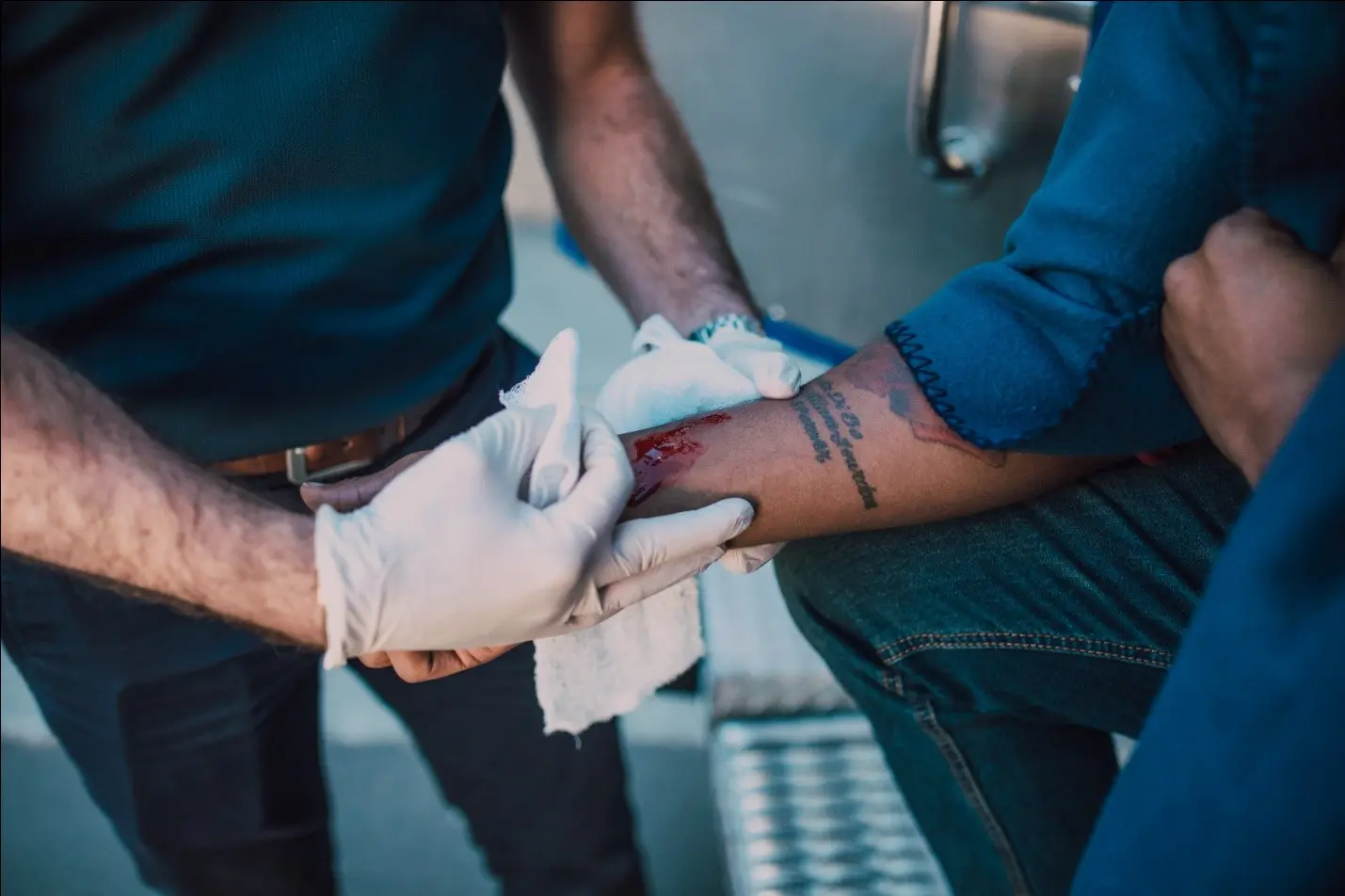 skin graft skin graft Wound Healing