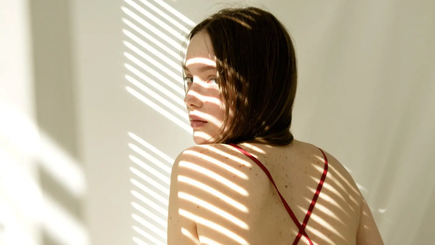 skin tags causes Skin Tags