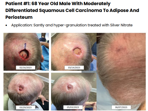 wound-care-1