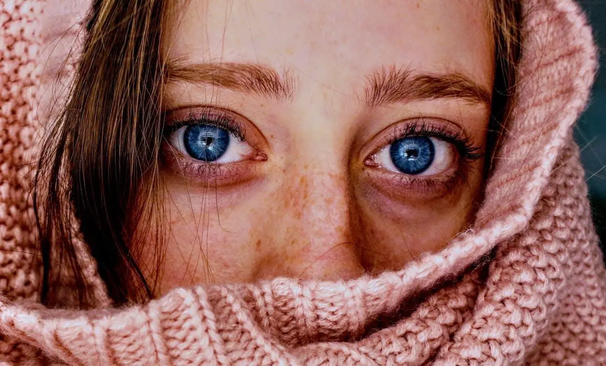 Rosacea What is Rosacea?