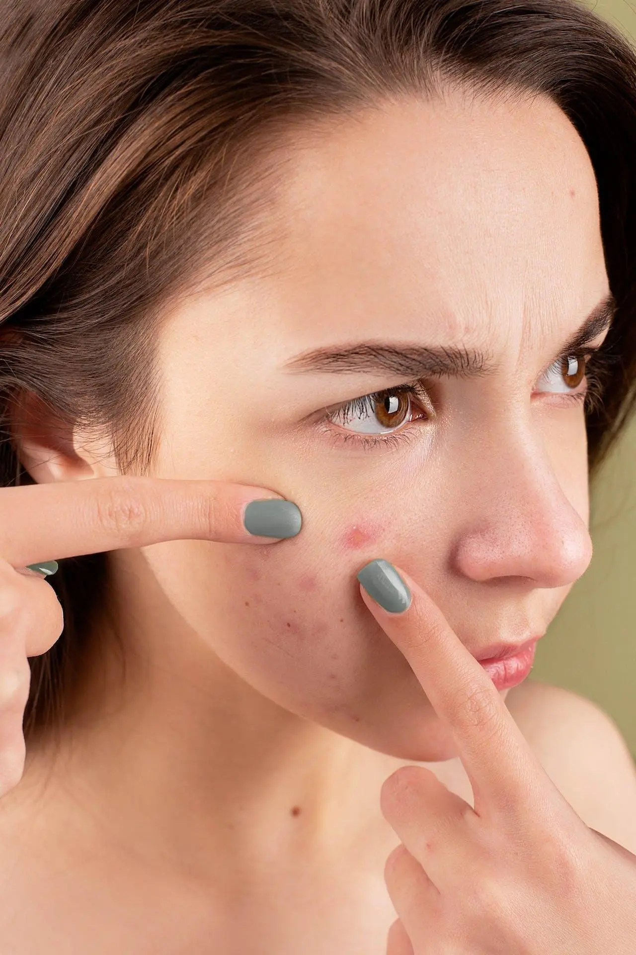 pimples Popping a Pimple