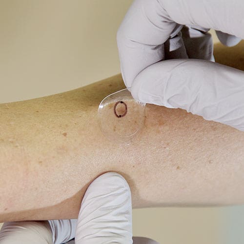 Test for Potential Skin Cancer Malignancy With Out a Scar