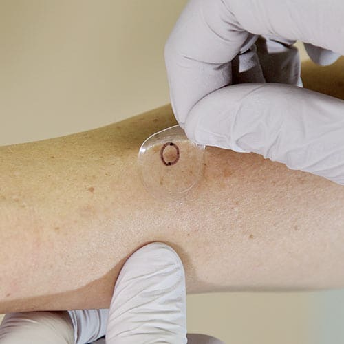 Test for Potential Skin Cancer Malignancy With Out a Scar