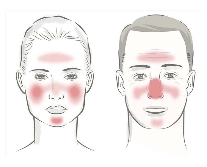skin rashes dermatology treatment
