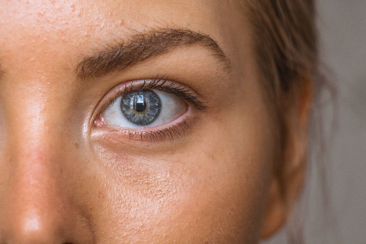 suncoast Photodynamic Therapy Photodynamic Therapy