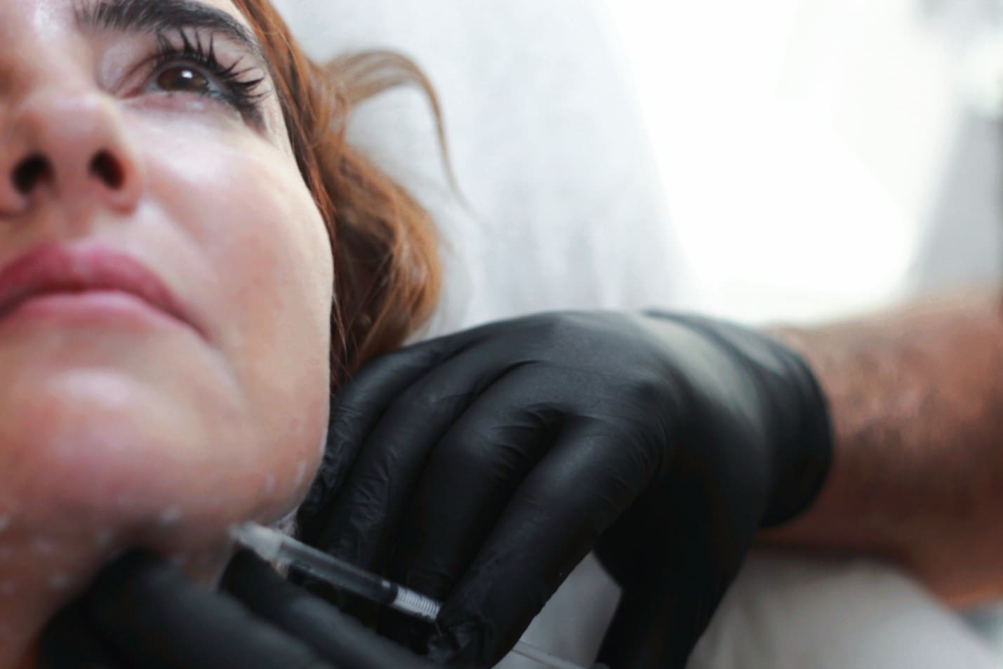 kybella injections - Suncoast Skin Solutions kybella