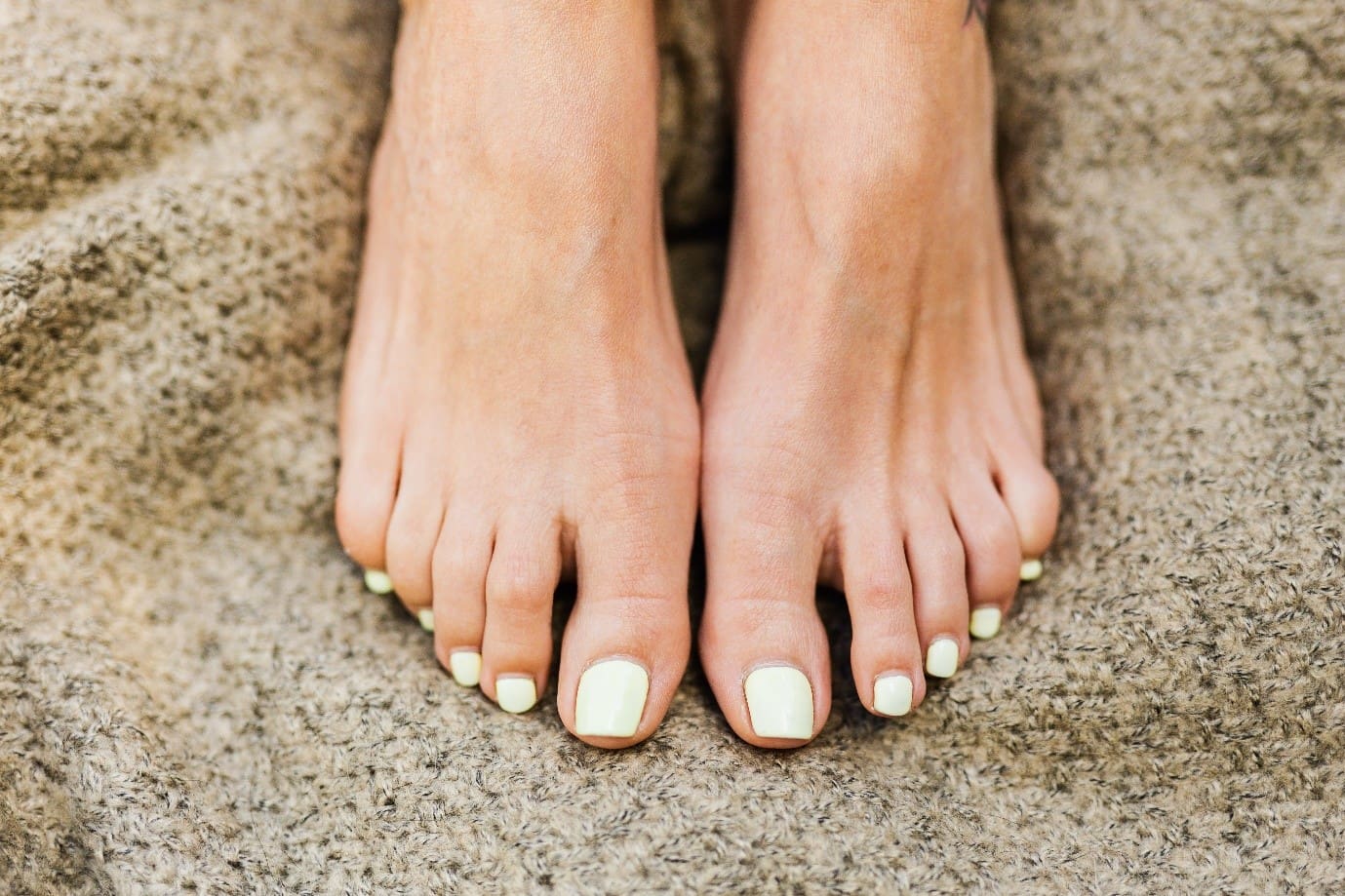 nail fungus Explaining Nail Fungus and Five Preventive Measures to Avoid it
