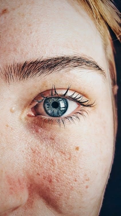 A woman with basal cell carcinoma showing her left eye