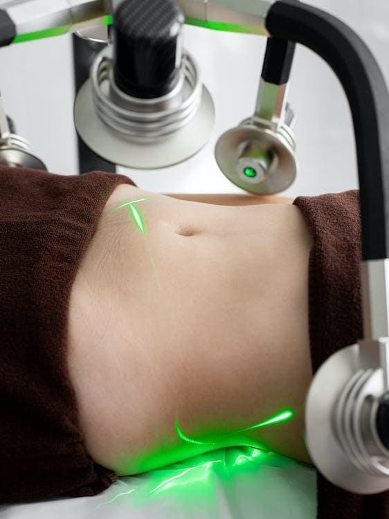 A woman undergoing a laser treatment for body contouring 