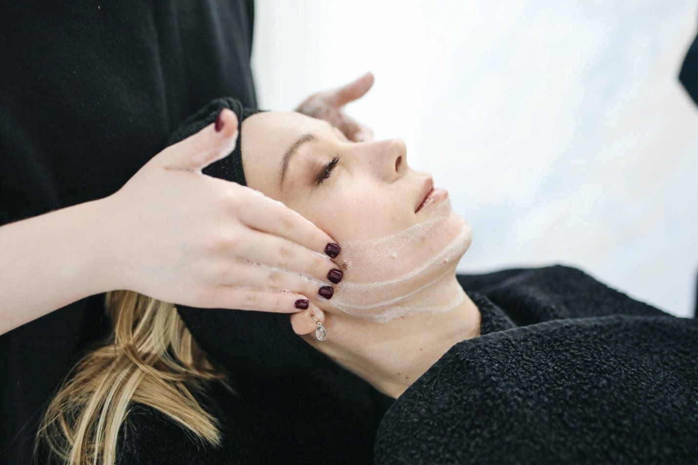 Facial Treatment Chemical peels