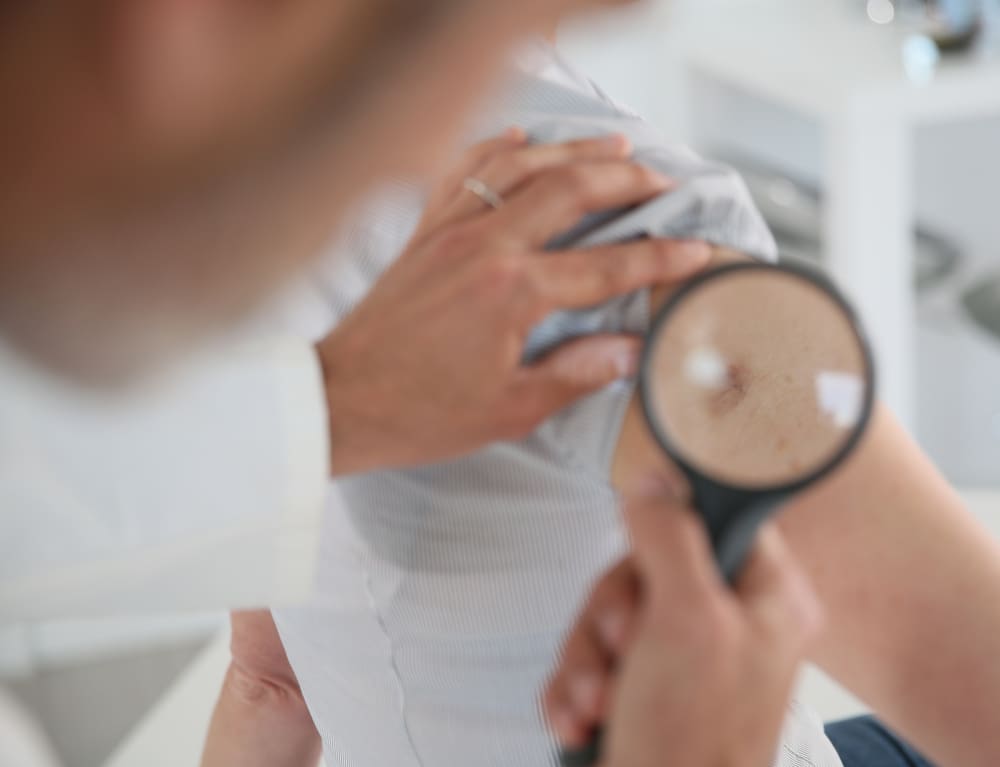 geriatric skin exam skin exam for older adults