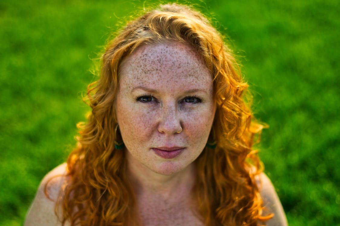 melasma - Suncoast Skin Solutions pregnancy mask