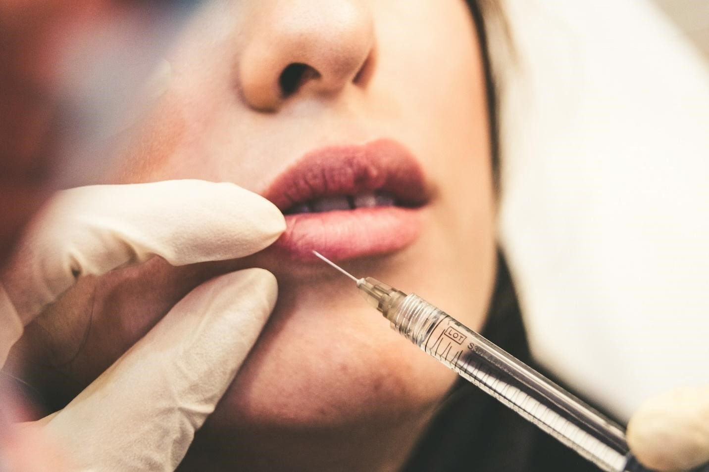 A Woman Getting a Dermal Filler Injection