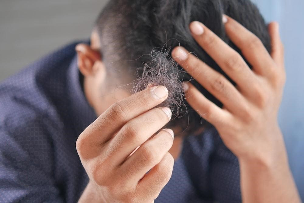 Treat Alopecia Areata with Platelet-Rich Plasma (PRP)