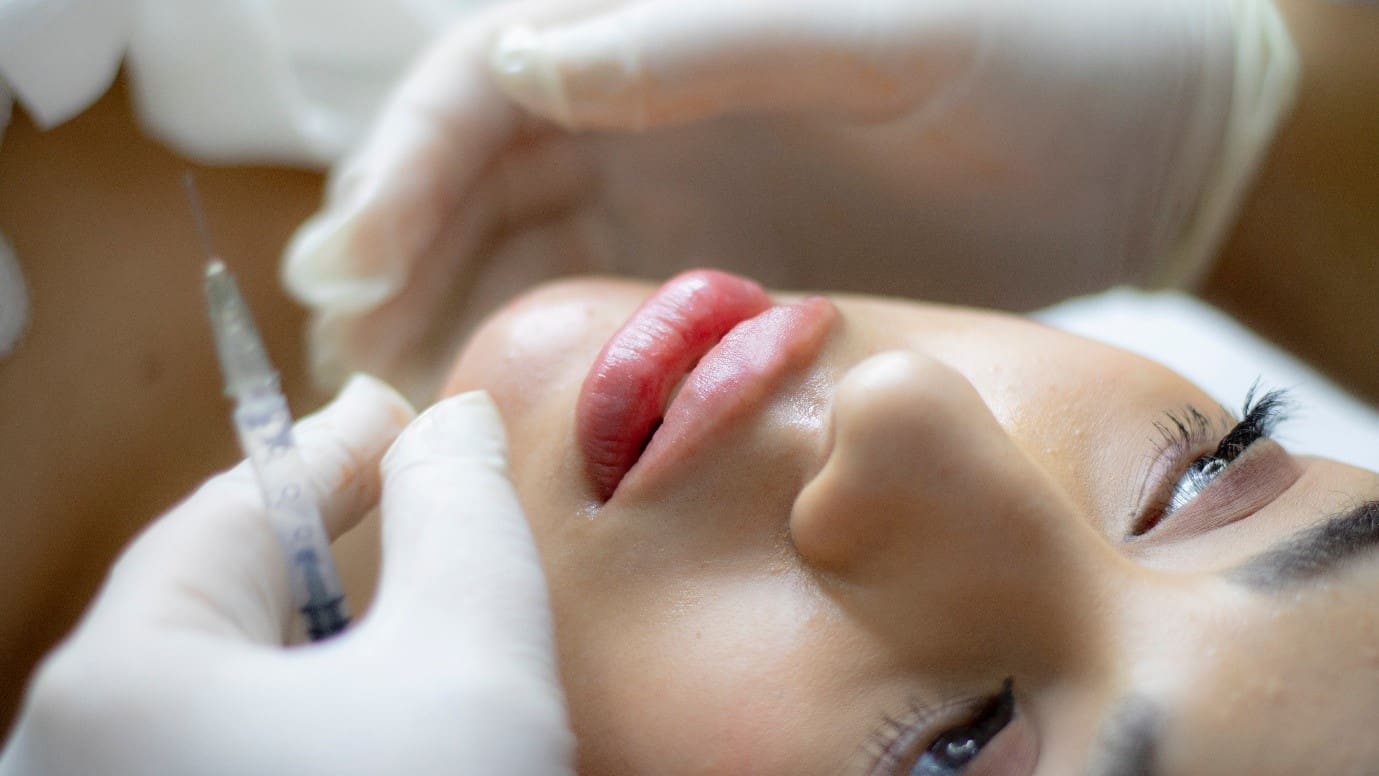 Dermal Fillers Explained- What are The Benefits You Can Gain from Them?