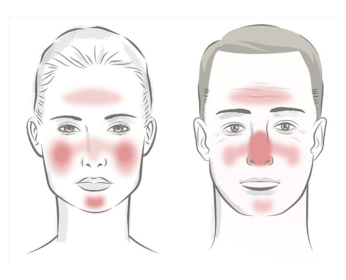 5 Common Skin Rashes in Adults
