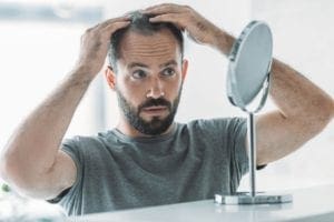 What Is Alopecia?