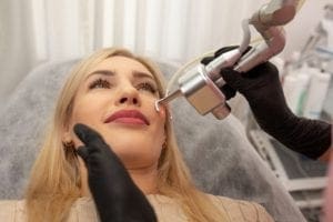 SmartSkin CO2 Laser Resurfacing