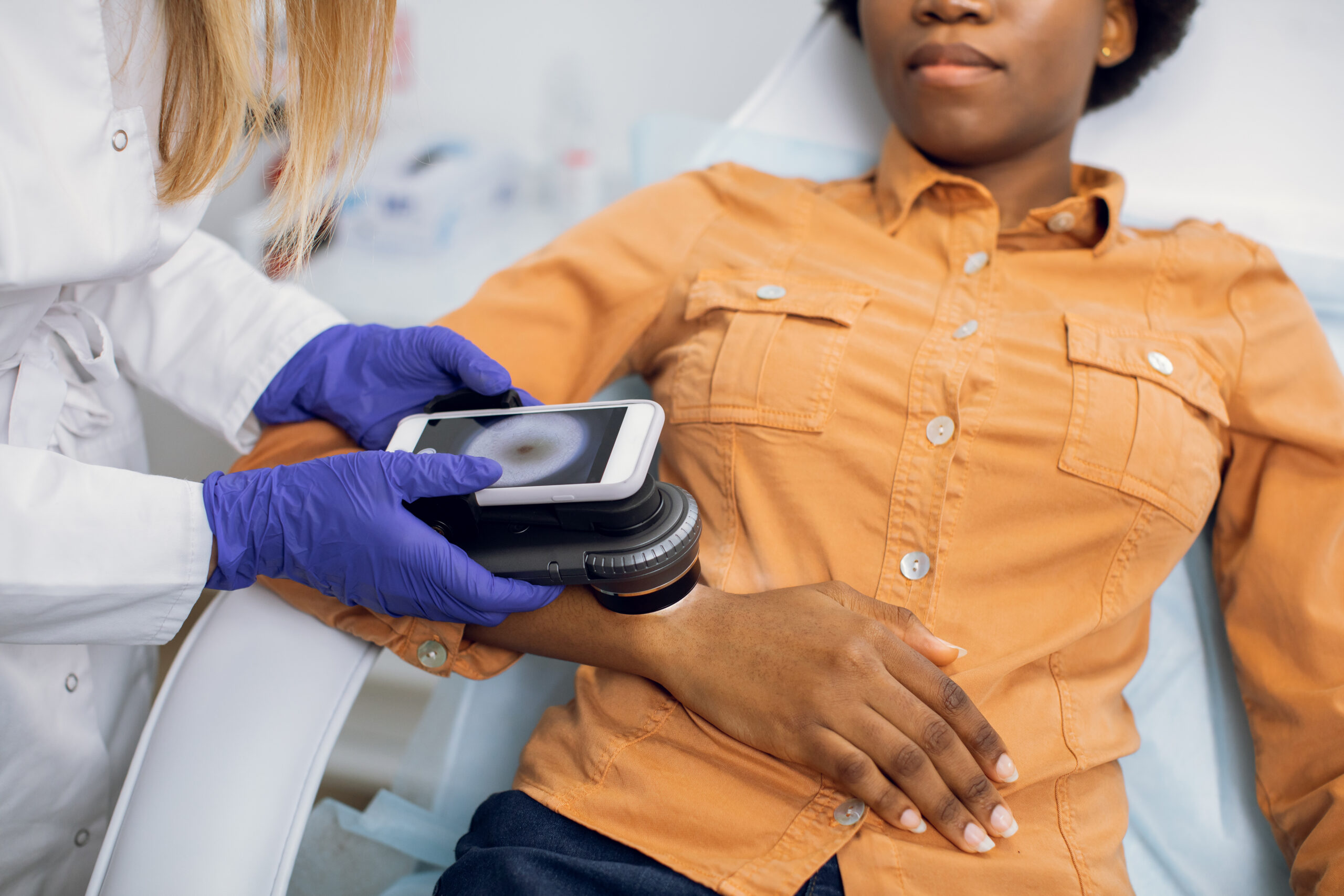 Skin Cancer Testing and Diagnosis